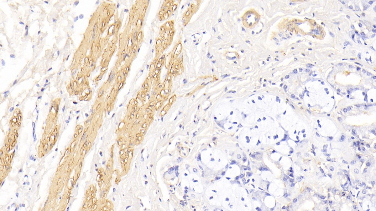 Actin Alpha 1 Cardiac Muscle Antibody (C302)