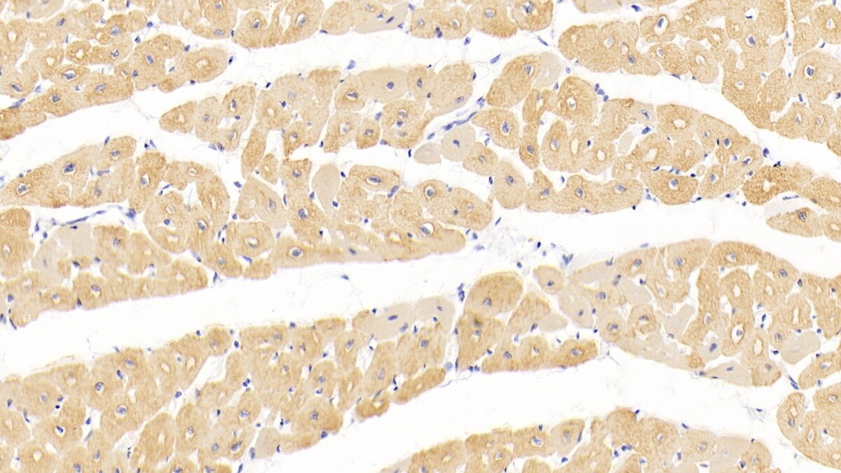 Actin Alpha 1 Cardiac Muscle Antibody (C302)