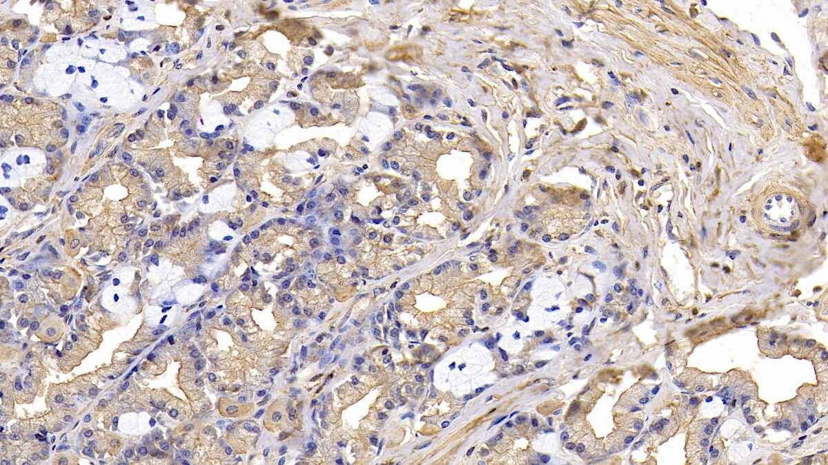 Actin Alpha 1 Cardiac Muscle Antibody (C6)