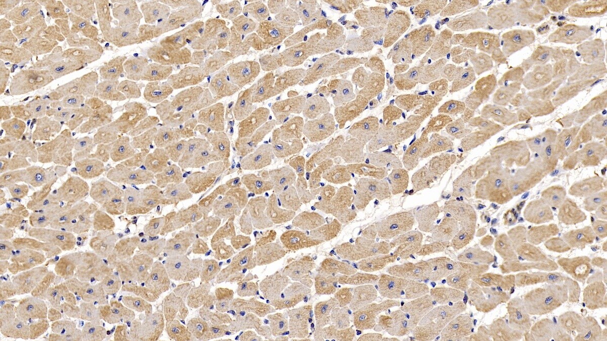 Actin Alpha 1 Cardiac Muscle Antibody (C6)
