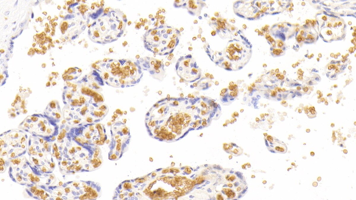 Hemoglobin A1 Antibody (C5)