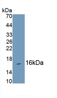 Hemoglobin A1 Antibody (C5)