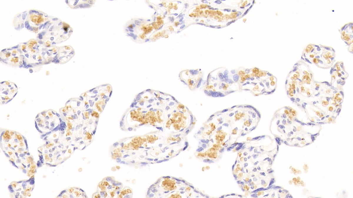 Hemoglobin A1 Antibody (C6)
