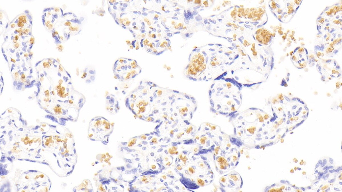 Hemoglobin A1 Antibody (C7)