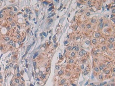 TLR1 Antibody (8-3#)