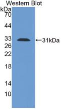 TLR1 Antibody (8-3#)