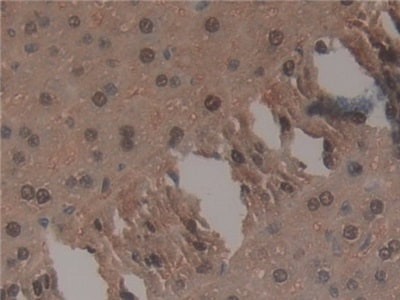 TNP1 Antibody