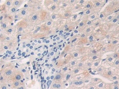 Calcineurin Antibody