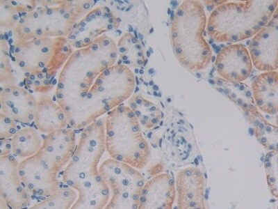 Plakophilin 1 Antibody