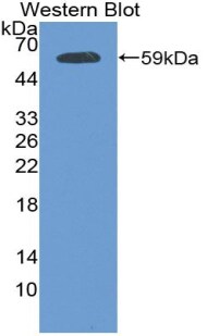 Plakophilin 1 Antibody