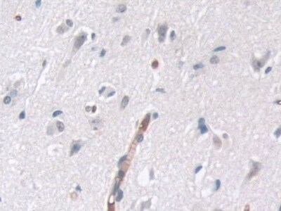 TTBK1 Antibody