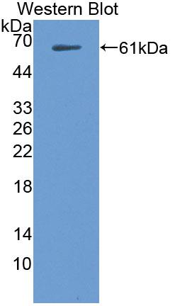 TTBK1 Antibody