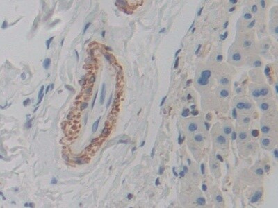 actin, gamma 2 Antibody