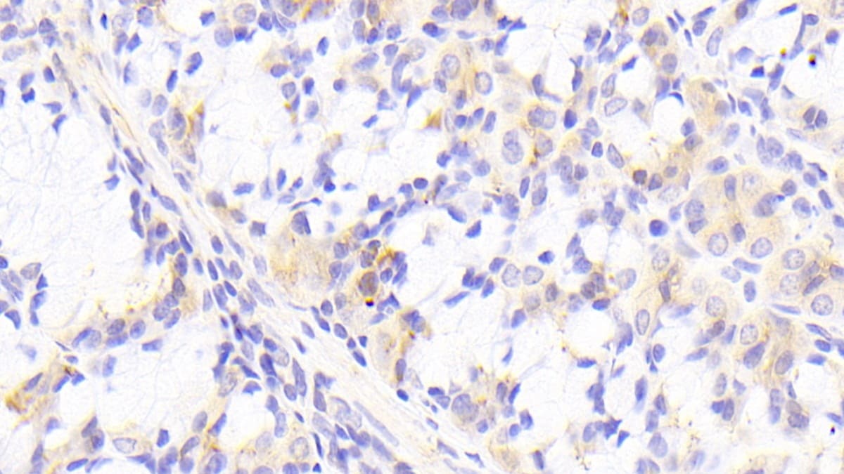PTPRK Antibody