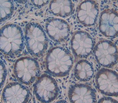 Gastrin-releasing Peptide/Bombesin/Neuromedin C Antibody