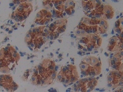 Plakophilin 2 Antibody