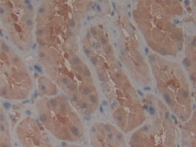 TEP1 Antibody