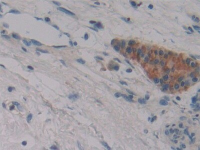 FBN3 Antibody