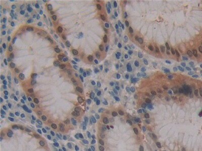 FBN3 Antibody