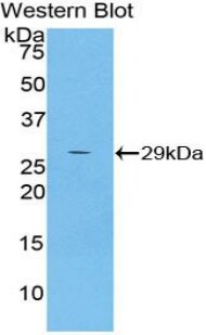 alpha 2-Macroglobulin-like 1/A2ML1 Antibody