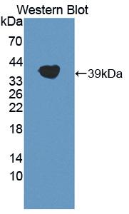 Lipoprotein a Antibody