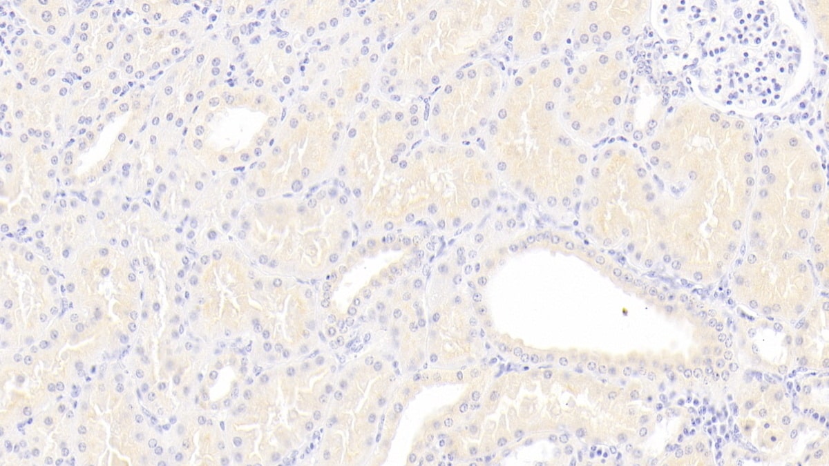 Lipoprotein a Antibody