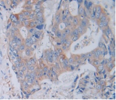 Cathepsin V Antibody