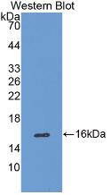 Catalase Antibody (1#)