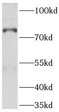 ABCD1 Antibody (9D11)