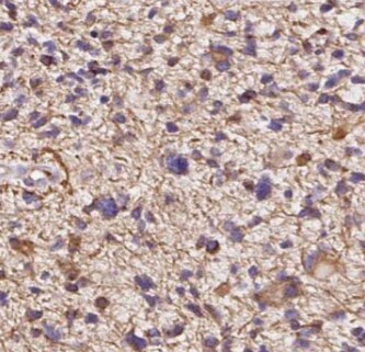 BCS1L Antibody (9G10)