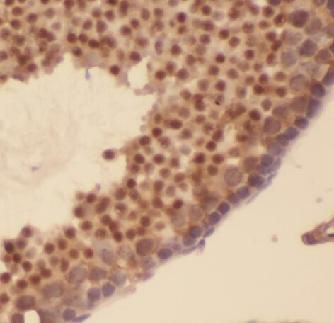 AKAP3 Antibody (0B8)