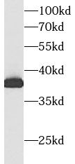 Aldolase C Antibody (6F3)
