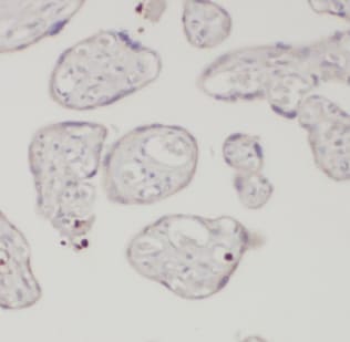 AMOT Antibody (2C9)
