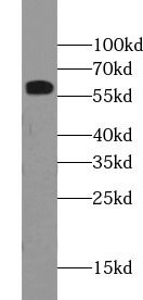 Pancreatic Amylase Alpha Antibody (1C7)