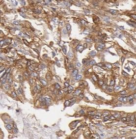Pancreatic Amylase Alpha Antibody (1C7)