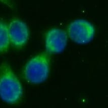 Pancreatic Amylase Alpha Antibody (1C7)