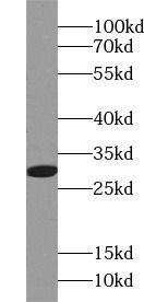 ANP32B Antibody (4F5)