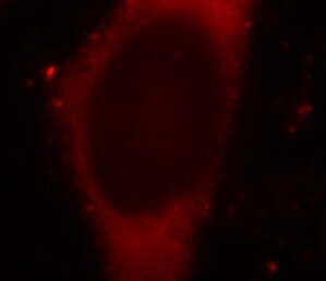BORIS Antibody (2B10)