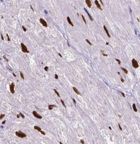 BRD8 Antibody (4B2)