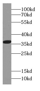 CAPZA1 Antibody (2C8)