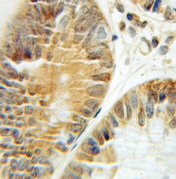 CCT3 Antibody (8C8)