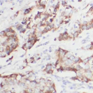 Calponin 2 Antibody (4C9)