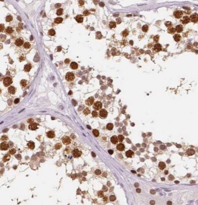 CPT1C Antibody (4E4)