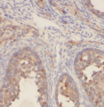 CTAGE1 Antibody (4F3)