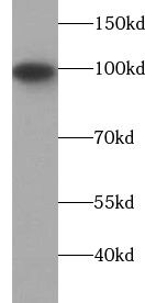 Isopeptidase T/USP5 Antibody (6G1)