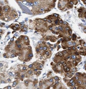 CYB5R3 Antibody (8H0)