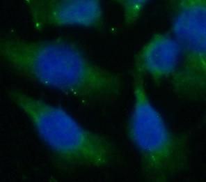 Cytoglobin Antibody (7F6)