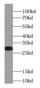 Cytoglobin Antibody (7F6)