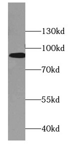 DBC1 Antibody (8C10)