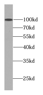 SART2 Antibody (3G11)